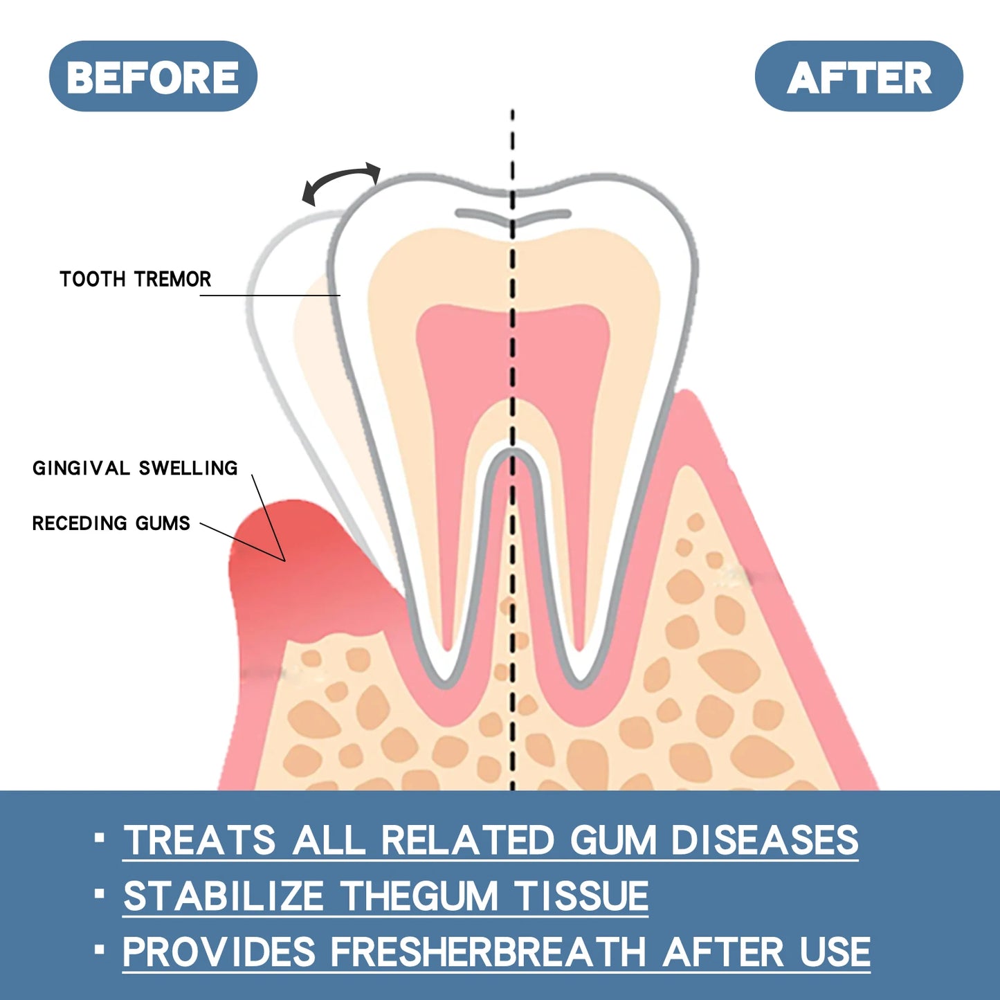 Gum Care Serum – Natural Oral Hygiene Drops for Fresh Breath & Gum Support (30ml)