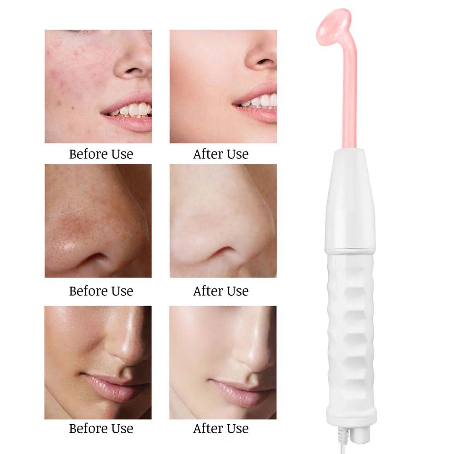 High Frequency Facial Machine – Skin Tightening & Wrinkle Remover with 4 Electrodes