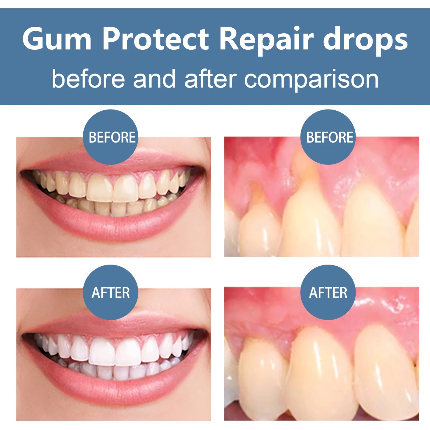 Gum Care Serum – Natural Oral Hygiene Drops for Fresh Breath & Gum Support (30ml)