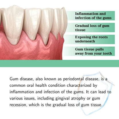 Gum Repair Drops – Receding Gum Care & Swelling Relief, Oral Hygiene & Stain Removal (30ml)