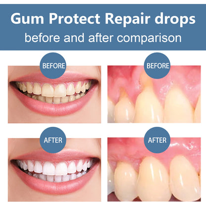 Gum Care Serum – Natural Oral Hygiene Drops for Fresh Breath & Gum Support (30ml)