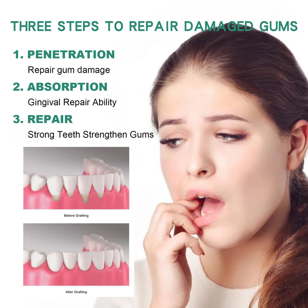 Gum Repair Drops – Receding Gum Care & Swelling Relief, Oral Hygiene & Stain Removal (30ml)